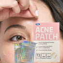 💋 Adesivos Antiacne Invisíveis — Cuida, protege e disfarça em segundos